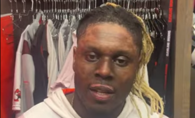 Cleveland Browns player gives 'all the glory to God' after surviving burn injuries to face